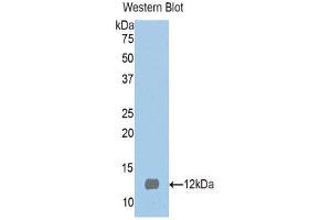 Western Blotting (WB) image for anti-S100 Protein (S100) (AA 2-94) antibody (ABIN1171955) (S100 Protein (S100) (AA 2-94) 抗体)