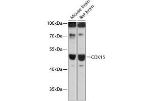 Western blot analysis of extracts of various cell lines, using CDK15 antibody (ABIN6131335, ABIN6138309, ABIN6138310 and ABIN6217056) at 1:3000 dilution. (Cyclin-Dependent Kinase 15 (ALS2CR7) (AA 271-400) 抗体)