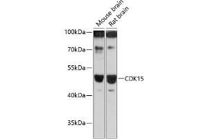 Western blot analysis of extracts of various cell lines, using CDK15 antibody (ABIN6131335, ABIN6138309, ABIN6138310 and ABIN6217056) at 1:3000 dilution. (Cyclin-Dependent Kinase 15 (ALS2CR7) (AA 271-400) 抗体)
