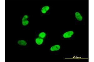 Immunofluorescence of monoclonal antibody to SOX9 on HepG2 cell. (SOX9 抗体  (AA 400-509))
