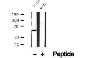 Western blot analysis of extracts of U-251 cells, using Sur-8 antibody. (SHoc2/Sur8 抗体  (C-Term))