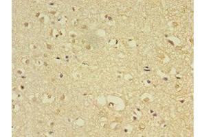 Immunohistochemistry of paraffin-embedded human brain tissue using ABIN7158118 at dilution of 1:100 (FLRT1 抗体  (AA 21-289))