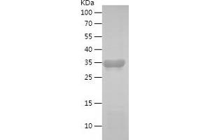 Western Blotting (WB) image for Replication Protein A1, 70kDa (RPA1) (AA 16-162) protein (His-IF2DI Tag) (ABIN7124825) (RPA1 Protein (AA 16-162) (His-IF2DI Tag))