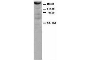 Image no. 1 for anti-Myosin, Light Chain 1, Alkali, Skeletal, Fast (MYL1) antibody (ABIN1502212) (MYL1 抗体)