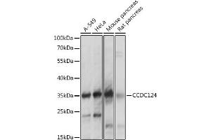Western blot analysis of extracts of various cell lines, using CCDC124 antibody  at 1:1000 dilution. (CCDC124 抗体  (AA 1-223))