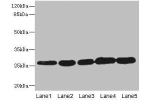 Western blot All lanes: GSTK1 antibody at 0. (GSTK1 抗体  (AA 1-226))