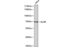 Western blot analysis of extracts of HeLa cells using IL23R Polyclonal Antibody at dilution of 1:1000. (IL23R 抗体)