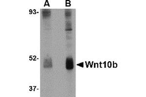 Western Blotting (WB) image for anti-Wingless-Type MMTV Integration Site Family, Member 10B (WNT10B) (Middle Region) antibody (ABIN1031166) (WNT10B 抗体  (Middle Region))