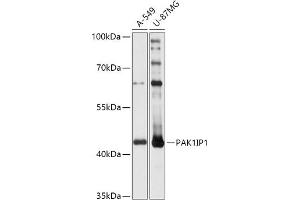 Western blot analysis of extracts of various cell lines, using PIP1 antibody (ABIN7269160) at 1:1000 dilution. (PAK1IP1 抗体  (AA 1-392))