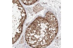 Immunohistochemical staining of human testis with MAGEB4 polyclonal antibody  shows moderate cytoplasmic and nuclear positivity in cells in seminiferus ducts at 1:200-1:500 dilution. (MAGEB4 抗体)