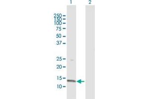 Western Blot analysis of CDA expression in transfected 293T cell line by CDA MaxPab polyclonal antibody. (CDA 抗体  (AA 1-146))