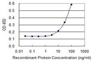 Detection limit for recombinant GST tagged CTRB1 is 3 ng/ml as a capture antibody. (CTRB1 抗体  (AA 101-200))
