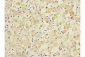 Immunohistochemistry of paraffin-embedded human liver tissue using ABIN7176327 at dilution of 1:100 (ZNF462 抗体  (AA 2223-2506))