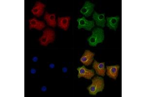 ABIN6259630 and ABIN6274207 staining Hela cells by IF/ICC.