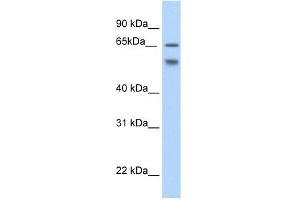 WB Suggested Anti-RBM35B Antibody Titration:  2. (ESRP2 抗体  (N-Term))