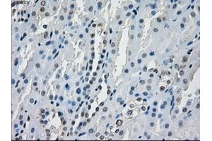 Immunohistochemical staining of paraffin-embedded endometrium tissue using anti-AURKCmouse monoclonal antibody. (Aurora Kinase C 抗体)