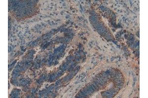 Used in DAB staining on fromalin fixed paraffin- embedded liver tissue (Biglycan 抗体  (AA 48-158))