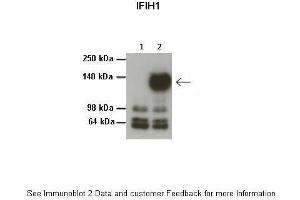 Lanes:   1: 20ug HEK293T no transfection, 2: 20ug HEK293T 3Flag-MDA5/IFIH1  Primary Antibody Dilution:   1:1000  Secondary Antibody:   Anti-rabbit HRP  Secondary Antibody Dilution:   1:1000  Gene Name:   IFIH1  Submitted by:   Dr. (IFIH1 抗体  (Middle Region))