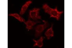 ABIN6274943 staining A549 cells by IF/ICC. (PDE4C 抗体  (Internal Region))