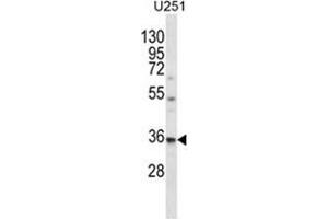 Western Blotting (WB) image for anti-Vacuolar Protein Sorting 37 Homolog B (VPS37B) (AA 98-127), (Middle Region) antibody (ABIN955524)