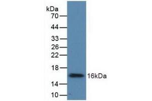 Detection of Recombinant UGCG, Human using Polyclonal Antibody to UDP Glucose Ceramide Glucosyltransferase (UGCG) (UGCG 抗体  (AA 39-171))