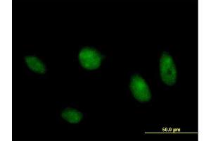 Immunofluorescence of purified MaxPab antibody to MAPK8 on HeLa cell. (JNK 抗体  (AA 1-427))