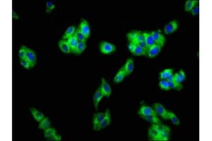 Immunofluorescence staining of HepG2 cells with ABIN7153159 at 1:133, counter-stained with DAPI. (FFAR1 抗体  (AA 143-178))