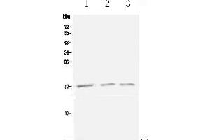 Western blot analysis of Lymphotactin using anti-Lymphotactin antibody . (XCL1 抗体  (AA 22-114))