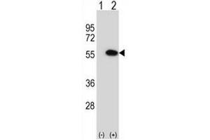 Western blot analysis of MINA (arrow) using rabbit polyclonal MINA Antibody (N-term) . (MINA 抗体  (N-Term))