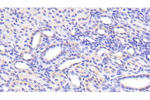 Immunohistochemistry (IHC) image for anti-Solute Carrier Family 39 (Zinc Transporter), Member 7 (SLC39A7) (AA 171-469) antibody (ABIN7445834)