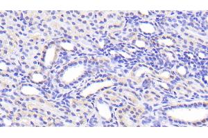 Detection of SLC39A7 in Human Kidney Tissue using Polyclonal Antibody to Solute Carrier Family 39, Member 7 (SLC39A7) (SLC39A7 抗体  (AA 171-469))