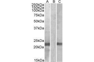 Western Blotting (WB) image for anti-Cystatin 8 (CST8) (Internal Region) antibody (ABIN2464863) (CST8 抗体  (Internal Region))