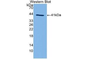 Western blot analysis of the recombinant protein. (C3a 抗体  (AA 670-742))