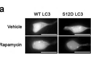 Western Blotting (WB) image for anti-Microtubule-Associated Protein 1 Light Chain 3 gamma (MAP1LC3C) (pSer12) antibody (ABIN2970987) (LC3C 抗体  (pSer12))