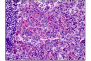 Human Tonsil: Formalin-Fixed, Paraffin-Embedded (FFPE) (Neuregulin 1 抗体  (Isoform 10, N-Term))