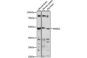 Western blot analysis of extracts of various cell lines, using W antibody (ABIN7271020) at 1:1000 dilution. (WARS2 抗体  (AA 211-360))