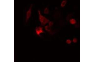 ABIN6277987 staining  Hela cells by IF/ICC. (Calretinin 抗体  (Internal Region))