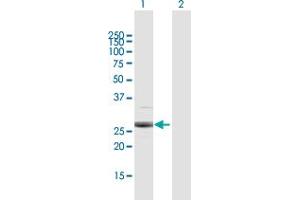 Western Blot analysis of PSMB4 expression in transfected 293T cell line by PSMB4 MaxPab polyclonal antibody.