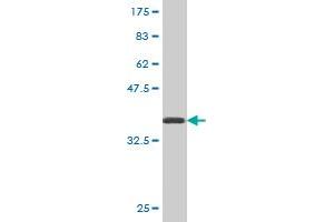 Western Blot detection against Immunogen (36. (ATG5 抗体  (AA 176-275))