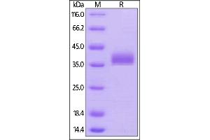 SDS-PAGE (SDS) image for Butyrophilin, Subfamily 1, Member A1 (BTN1A1) (AA 27-242) protein (His tag,AVI tag,Biotin) (ABIN5674585)