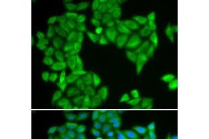 Immunofluorescence analysis of HeLa cells using SPAG5 Polyclonal Antibody (SPAG5 抗体)