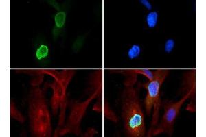 Fluorescence Microscopy (FM) image for anti-Histone 3 (H3) (H3K56me3) antibody (ABIN5706777)