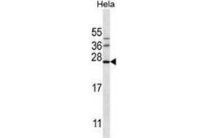 Western blot analysis in Hela cell line lysates (35ug/lane) using Serglycin / PRG1 Antibody (C-term). (SRGN 抗体  (C-Term))
