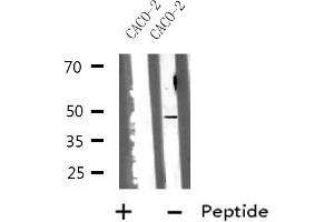 Western blot analysis of HSD17B2 using CACO-2 whole cell lysates (HSD17B2 抗体  (C-Term))