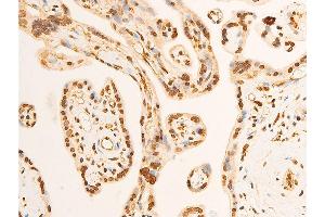 ABIN6267301 at 1/100 staining human placenta tissue sections by IHC-P. (EIF2S1 抗体  (pSer51))