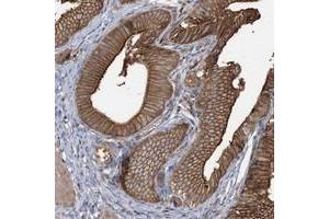 Immunohistochemical staining of human gallbladder with CCNY polyclonal antibody  shows strong cytoplasmic and membranous positivity in glandular cells at 1:50-1:200 dilution. (Cyclin Y 抗体)