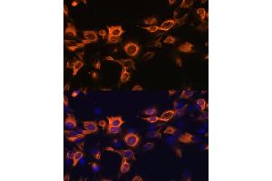 Immunofluorescence analysis of C6 cells using CSF2 antibody (ABIN6130426, ABIN6139094, ABIN6139095 and ABIN6221725) at dilution of 1:100. (GM-CSF 抗体  (AA 18-144))