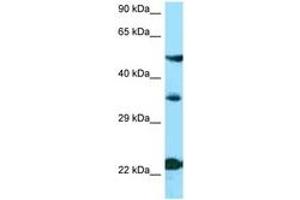 Image no. 1 for anti-Melanocortin 4 Receptor (MC4R) (N-Term) antibody (ABIN6748393) (MC4R 抗体  (N-Term))