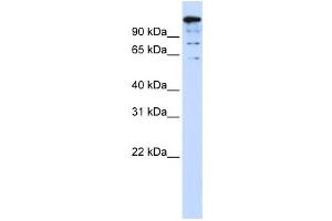 Western Blotting (WB) image for anti-BTB and CNC Homology 1, Basic Leucine Zipper Transcription Factor 2 (BACH2) antibody (ABIN2458413) (BACH2 抗体)