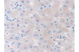 Detection of MMP3 in Human Liver Tissue using Monoclonal Antibody to Matrix Metalloproteinase 3 (MMP3) (MMP3 抗体  (AA 363-477))